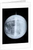 Globe x-ray by Benjamin Martin