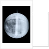 Globe x-ray by Benjamin Martin