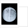 Globe x-ray by Benjamin Martin