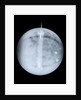 Globe x-ray by Benjamin Martin
