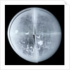 Globe x-ray by Newton Son & Berry