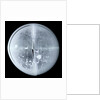Globe x-ray by Newton Son & Berry