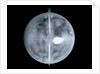 Globe x-ray by Nathaniel Hill