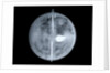 Globe x-ray by Nathaniel Hill