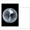 Globe x-ray by Nathaniel Hill