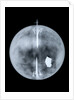 Globe x-ray by Nathaniel Hill