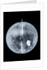 Globe x-ray by Nathaniel Hill