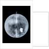 Globe x-ray by Nathaniel Hill