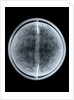 Globe x-ray by William Bardin