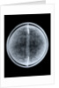 Globe x-ray by William Bardin