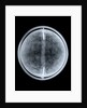Globe x-ray by William Bardin