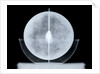 Globe x-ray by William Bardin
