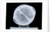 Globe x-ray by William Bardin