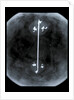 Globe x-ray by Gerard Mercator
