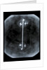 Globe x-ray by Gerard Mercator
