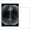 Globe x-ray by Gerard Mercator