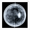 Globe x-ray by Jacob Floris van Langren