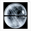 Globe x-ray by Arnold Floris van Langren