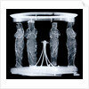 Globe x-ray by Hyacinthe Langlois