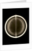 Globe x-ray by Joannes Oterschaden