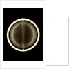 Globe x-ray by Joannes Oterschaden