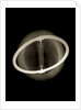 Globe x-ray by Joannes Oterschaden