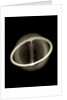 Globe x-ray by Joannes Oterschaden