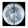 Globe x-ray by Jodocus Hondius Jr