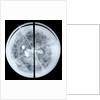 Globe x-ray by Jodocus Hondius Jr