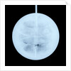 Globe x-ray by Peter Anich