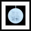 Globe x-ray by Peter Anich