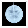 Globe x-ray by Peter Anich