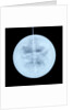 Globe x-ray by Peter Anich