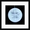 Globe x-ray by Peter Anich