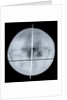 Globe x-ray by Gemma Frisius