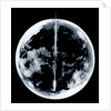 Globe x-ray by unknown