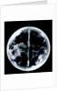 Globe x-ray by unknown