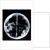 Globe x-ray by unknown