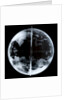 Globe x-ray by unknown