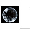 Globe x-ray by unknown