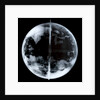 Globe x-ray by unknown
