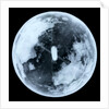 Globe x-ray by unknown