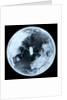 Globe x-ray by unknown