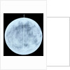 Globe x-ray by Giovanni Maria Cassini