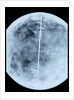 Globe x-ray by Giovanni Maria Cassini