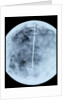 Globe x-ray by Giovanni Maria Cassini
