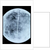 Globe x-ray by Giovanni Maria Cassini
