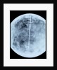 Globe x-ray by Giovanni Maria Cassini