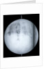 Globe x-ray by Guillaume de L'Isle