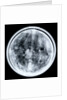 Globe x-ray by Jacques Hardy
